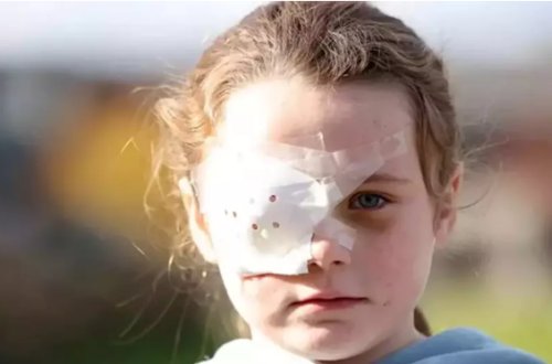 Elektron siqaretin partlaması 7 yaşlı qızı kor etdi