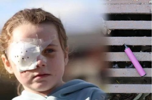 Elektron siqaret partladı, 7 yaşlı qız gözünü itirdi