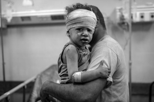 Qəzzada vəziyyət daha da gərginləşir - Xəstəxanalarda uşaq həkimi tapılmır