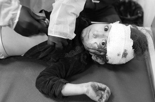 Qəzzada ölənlərin sayı 44 min 249-a yüksəldi