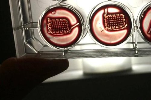 Xəstələrin qanı ilə qırılan sümükləri müalicə edəcək implant hazırlanıb