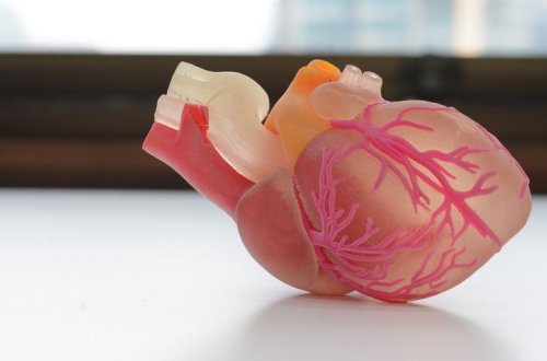 İtaliyada dünyada ilk dəfə döyünən ürək transplantasiyası keçirilib