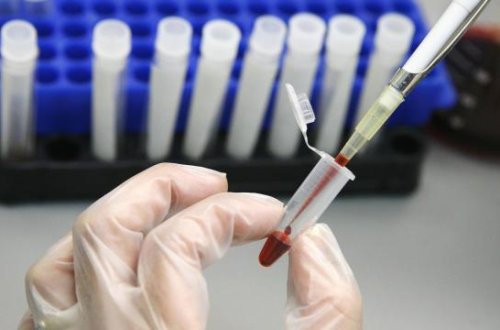 HİV-ə yoluxduğunu həyat yoldaşından gizlədib