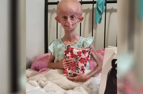 Beandri Buysen öldü - Hər il səkkiz yaş qocalırdı... - FOTO