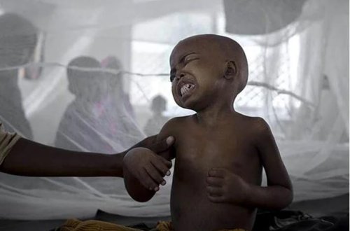 Sudanda vəba epidemiyası: Ölənlərin sayı 1258-ə yüksəldi 