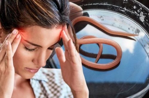 64 yaşındakı qadın baş ağrısı şikayəti ilə getdi! Beynindən çıxanlar hətta həkimləri də təəccübləndirib