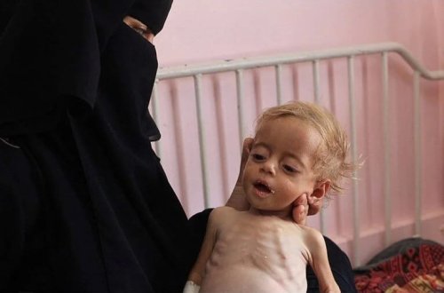 ABŞ İsraili qorumaq üçün gözlərini yumdu: Qəzzada aclıq yox idi! 