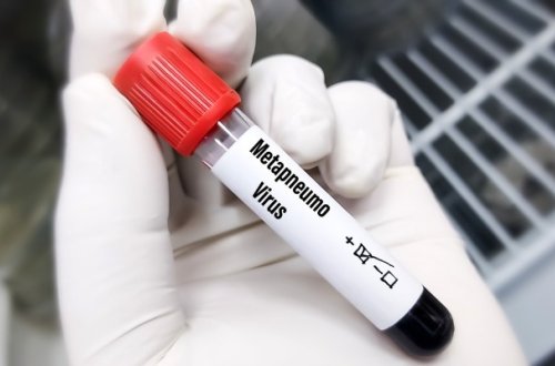 Daha bir ölkədə metapnevmovirus yoluxması aşkar edilib