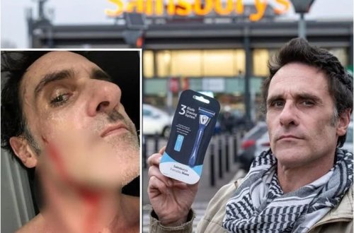 Üzünü ülgüclə kəsdi, 6 min 650 dollar qazandı