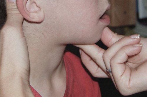 Uşaq cərrahı çöpçülərlə bağlı valideynlərə müraciət edib