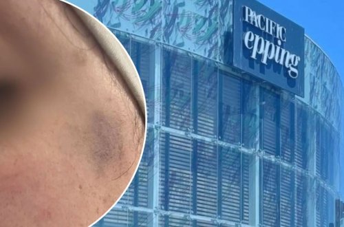 Hamilə qadını çadra ilə boğmağa çalışdılar - Bu ölkənin baş naziri müsəlmanlardan üzr istədi