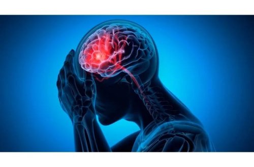 Alimlər açıqladı: Gənclərdə insult riski 7 dəfə artıb