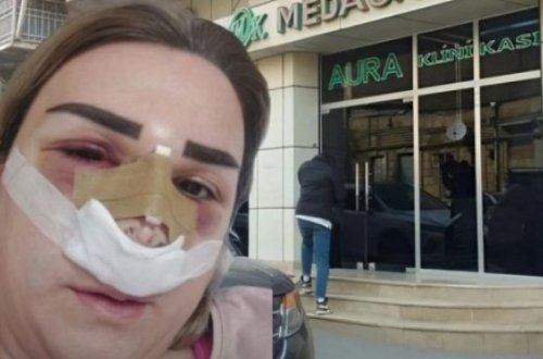 “MedAura”nın həkimi Kəmalə Mirzəyevanın yanlış əməliyyatı problem yaradıb – VİDEO
