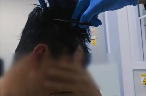 Parik altında 10 min avro dəyərində narkotik ticarəti