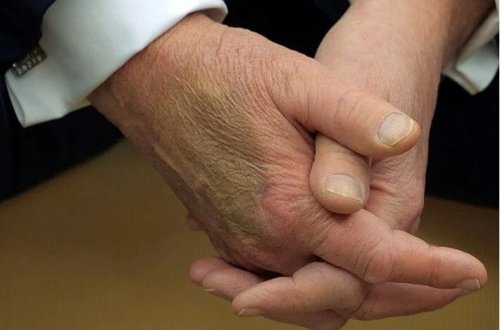 Trampın əlləri gündəmdədir: Sosial mediada göyərmə müzakirəsi