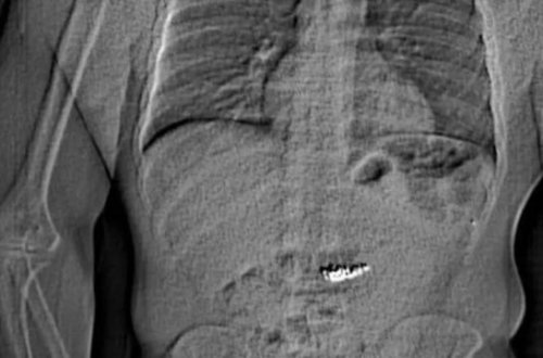 Polisi görən oğru oğurladığı brilyant sırğaları udub