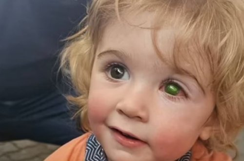 2 yaşlı uşaq kor oldu - İnanılmaz səbəb