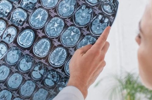 Kəlləsini qarnında gəzdirdi