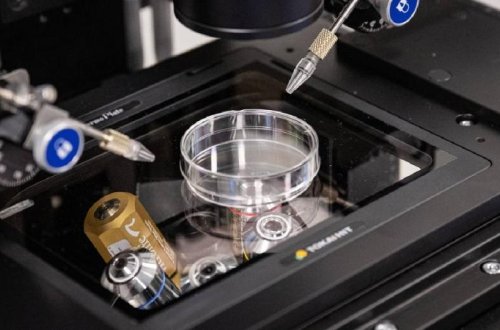 Avstraliyada süni mayalanma qalmaqalı: Başqasının körpəsini dünyaya gətirdi