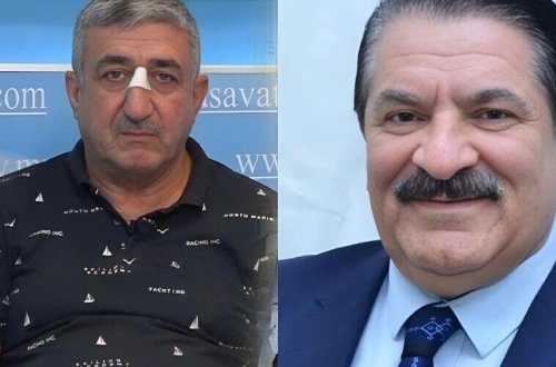 Ağadadaş Ağayevin balta atdığı mühafizəçi həbs edildi