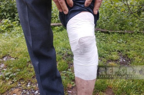 Oğuzda çaqqal 56 yaşlı kişiyə hücum edib