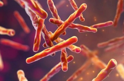 ABŞ-də vərəmə yoluxma halı aşkarlandı