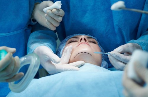 Əməliyyatla özünü pişiyə bənzətdi - VİDEO