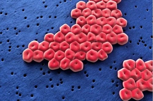 Plastik yeyən super bakteriyalar xəstəxanalarda yayılır