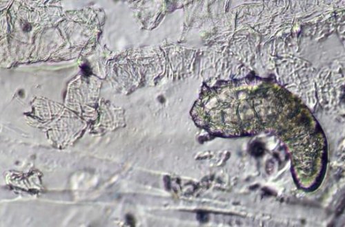 Yatarkən üzünüzdə yaşayan canlılar iş başında ola bilər