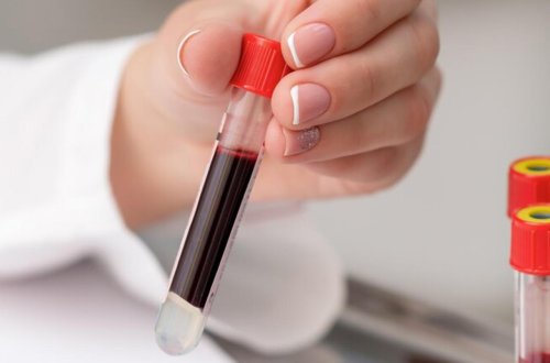 Bütün qan qruplarına uyğun gələn süni qan hazırlandı