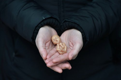 Parlament qanunsuz aborta görə cəzaların sərtləşdirilməsini son oxunuşda təsdiqləyib