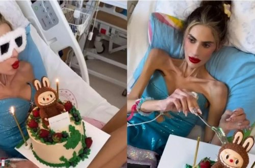 Anoreksiya xəstəsi olan fenomen daha 1 kilo arıqladı