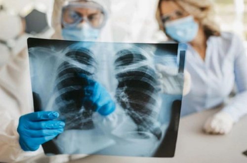 Qobustan Regional Xəstəxanasında 160 vərəm xəstəsi qeydiyyatdadır