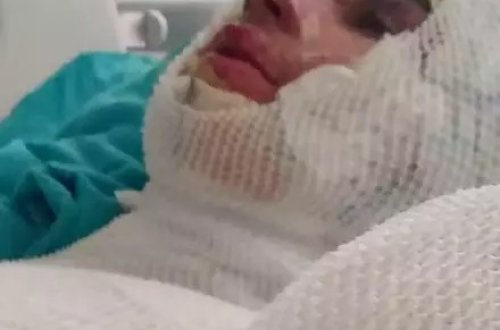 Mirasa görə 16 yaşlı qardaşı oğlunu yandırdı - FOTO