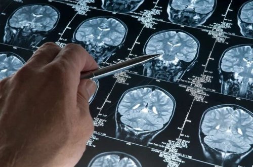 İnsan beyni işıq saçır