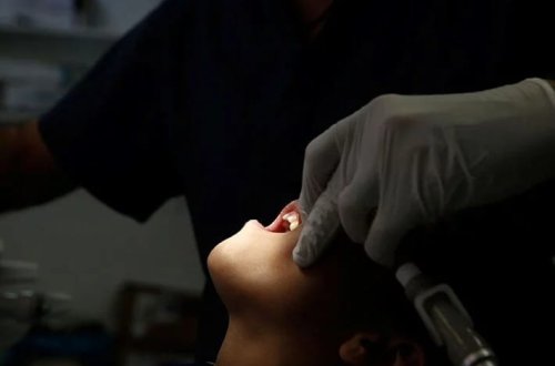 Saxta diş həkimi qalmaqalı: Onlayn videolara baxaraq kanal müalicəsi apardılar