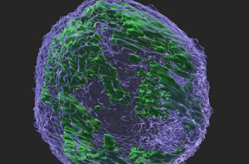 Xərçəng xəstəliyi hüceyrələrinin yayılmasının qarşısını alan maddə tapılıb