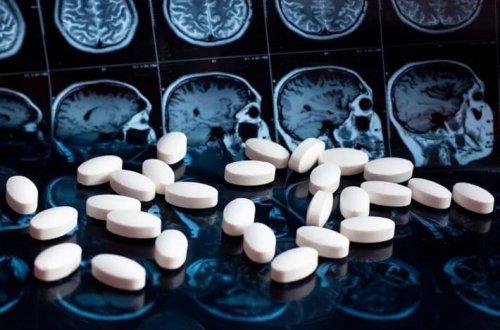 Alzheimerə qarşı gündə bir həb insanlar üzərində sınaqdan keçiriləcək