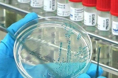 “Virus hələ də bizimlədir” – Səhiyyə Nazirliyi xəbərdarlıq edir