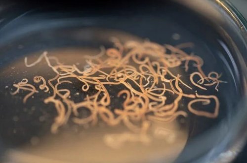 Ölümcül parazit xəbərdarlığı: Bədənə nüfuz edir, insanlarla qidalanır 