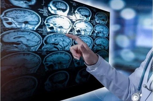 Xatirələrimiz sabit deyil: Beyin eyni hadisəni hər dəfə fərqli şəkildə qeyd edir