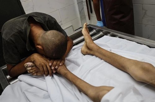 Qəzzada aclıqdan ölənlərin sayı 180-ə çatdı