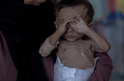 Daha bir uşaq tibbi çatışmazlıq səbəbindən ölüb