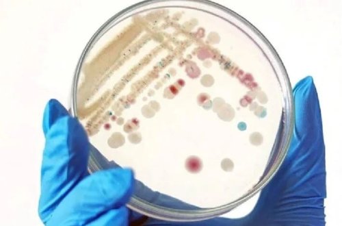 Ət yeyən bakteriyalar 9 nəfəri öldürdü
