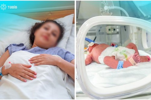 TƏBİB: Metroda doğulan körpə süni tənəffüs aparatına qoşulub