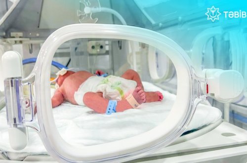 TƏBİB: Metroda doğulan körpə süni tənəffüs aparatından ayrılıb, vəziyyəti yaxşılaşır