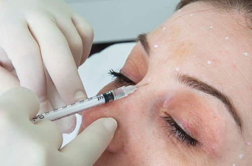 Botox və dolğu etdirənlərə - Rəsmi xəbərdarlıq