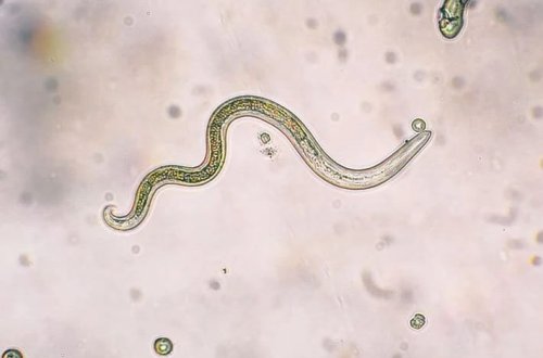 Parazitin gizli sirri: Bədənə nüfuz edir və ağrı hiss edən sinirləri bağlayır