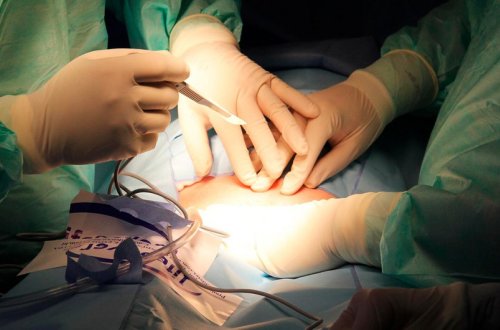 Alimlər ilk dəfə donuzun ağciyərini insan bədəninə köçürüblər