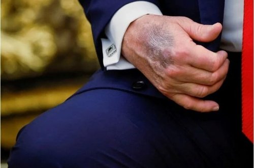 Trampın əli yenidən gündəmə gəlib